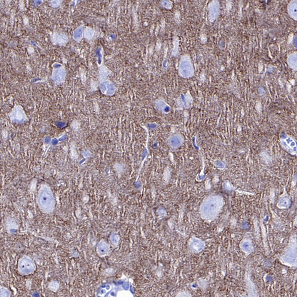 SLIT2 Recombinant Rabbit mAb (S-730-41)