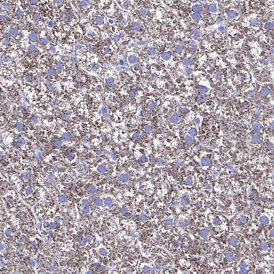 Hepatocyte Specific Antigen Recombinant Mouse mAb (SDT-4389)