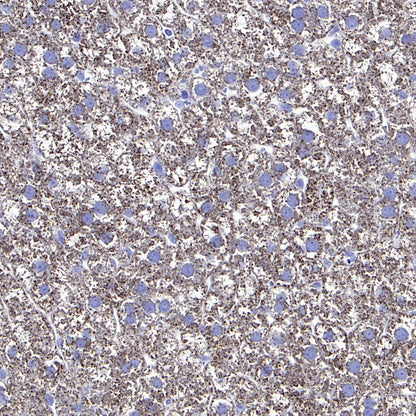 Hepatocyte Specific Antigen Recombinant Mouse mAb (SDT-4389)