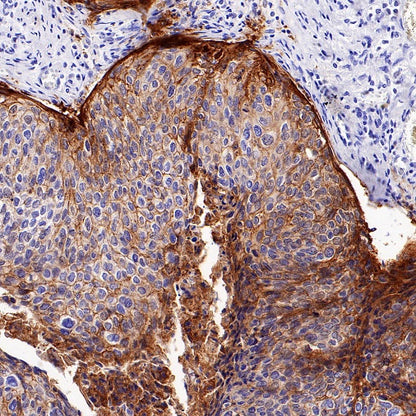 Integrin beta 6 Recombinant Rabbit mAb (SDT-1445-78)