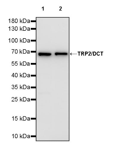 TRP2/DCT Recombinant Rabbit mAb (S-1749-19)