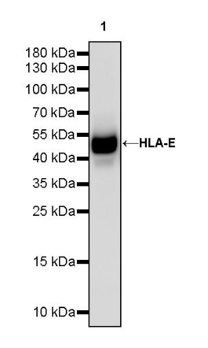 HLA-E Recombinant Rabbit mAb (S-1081-62)