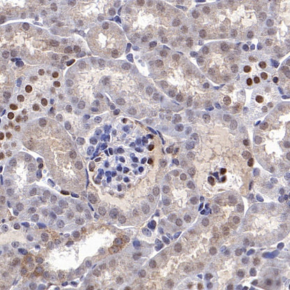 SMAD2 Recombinant Rabbit mAb (S-1521-177)