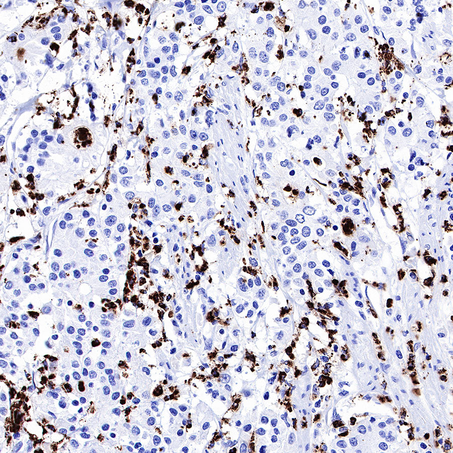 MPO Recombinant Rabbit mAb (SDT-224-19)