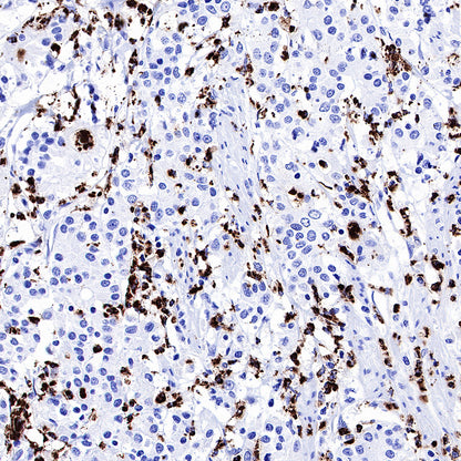 MPO Recombinant Rabbit mAb (SDT-224-19)