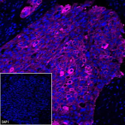 CK-Pan Recombinant Rabbit mAb (Alexa Fluor® 647 Conjugate) (S-P001)