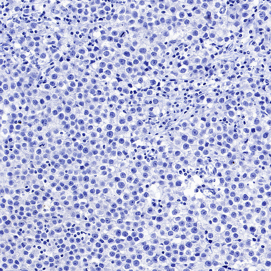 Inhibin alpha Recombinant Rabbit mAb (SDT-3212-24)