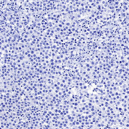 Inhibin alpha Recombinant Rabbit mAb (SDT-3212-24)