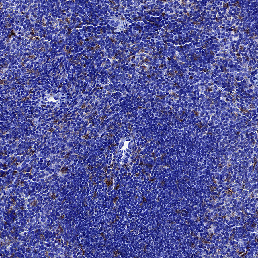 LPCAT2 Recombinant Rabbit mAb (S-4239-18)