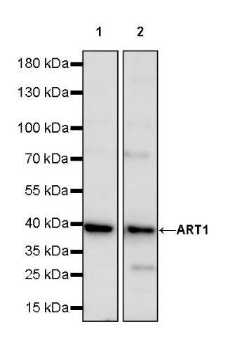 ART1 Recombinant Rabbit mAb (S-2396-1)