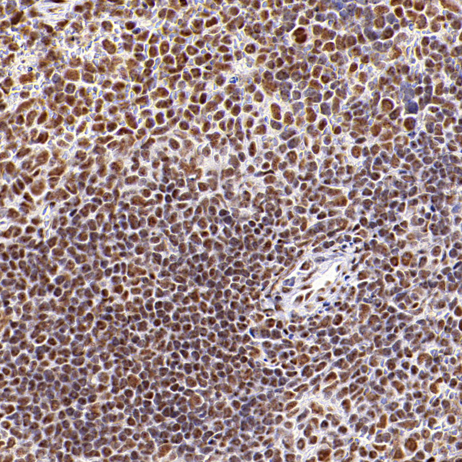 SF3B1 Rabbit Polyclonal Antibody