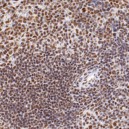 SF3B1 Rabbit Polyclonal Antibody
