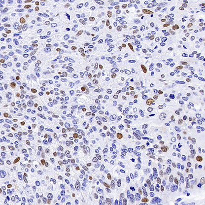 Cyclin E2 Recombinant Rabbit mAb (S-5247)