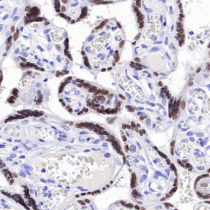 ATF3 Recombinant Rabbit mAb (SDT-4100)