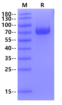 Biotinylated TSLPR Fc&Avi Tag Protein, Human