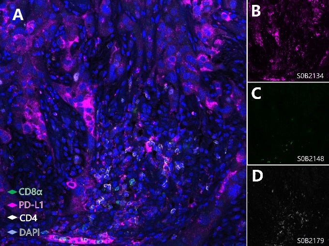 PD-L1, Cytotoxic T cell and Helper T cell (PD-L1, CD8α, CD4) Antibody Panel