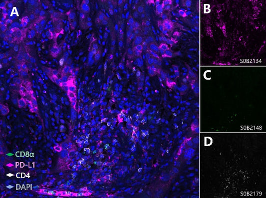 PD-L1, Cytotoxic T cell and Helper T cell (PD-L1, CD8α, CD4) Antibody Panel
