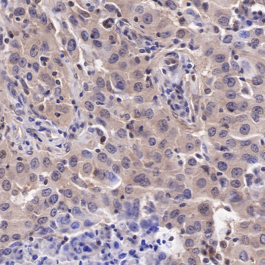 Akt (pan) Recombinant Rabbit mAb (SDT-R169)