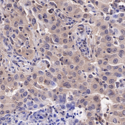 Akt (pan) Recombinant Rabbit mAb (SDT-R169)