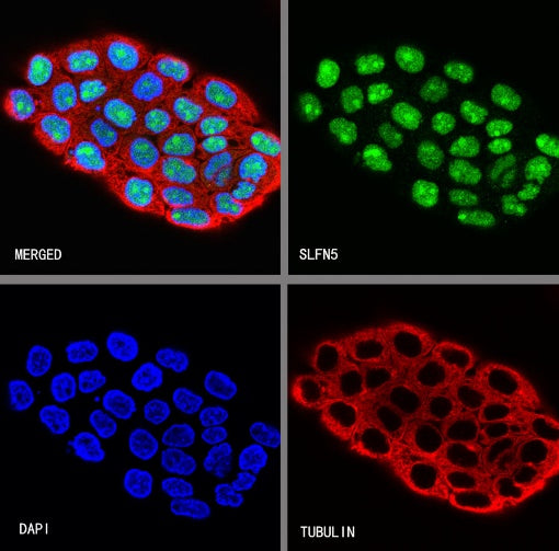 SLFN5 Rabbit Polyclonal Antibody