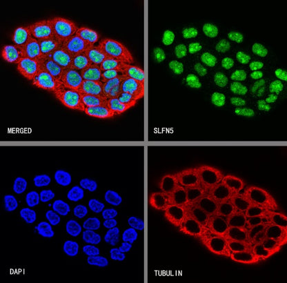 SLFN5 Rabbit Polyclonal Antibody