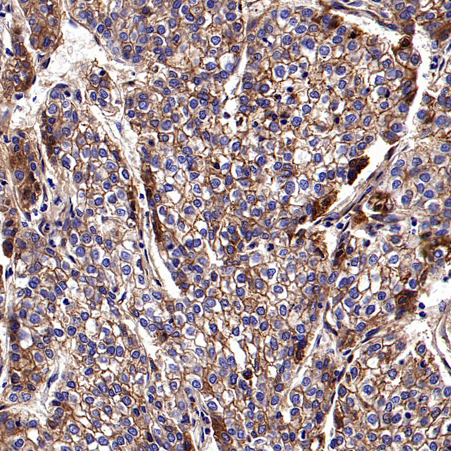 PTK7 Recombinant Rabbit mAb ,PBS Only(SDT-2432-136)
