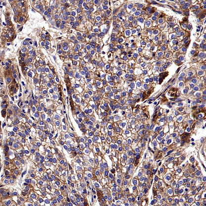 PTK7 Recombinant Rabbit mAb ,PBS Only(SDT-2432-136)