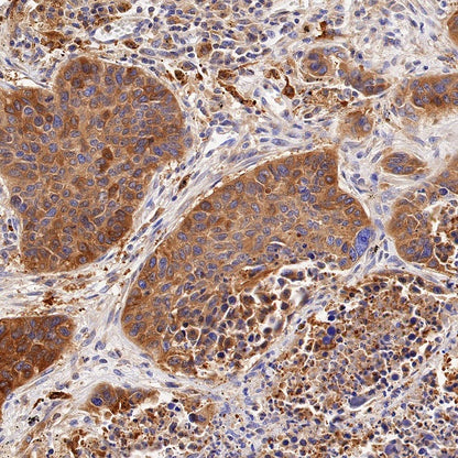 PKM2 Rabbit Polyclonal antibody