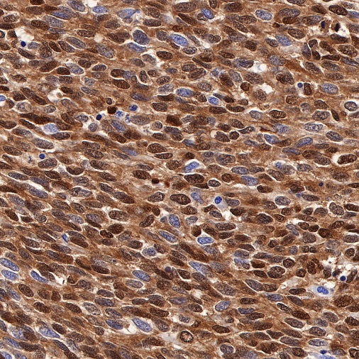 S-RMab® S100B Recombinant Rabbit mAb (SDT-518-45)
