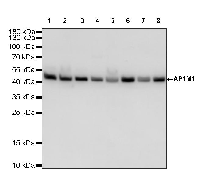AP1M1 Recombinant Rabbit mAb (S-4593-28)