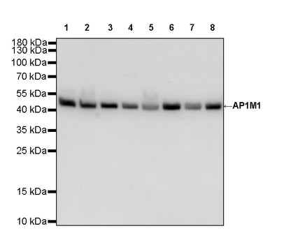 AP1M1 Recombinant Rabbit mAb (S-4593-28)