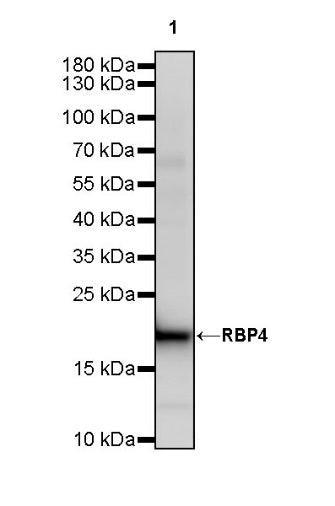 RBP4 Recombinant Rabbit mAb (S-693-111)