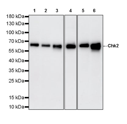 Chk2 Recombinant Rabbit mAb