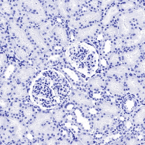 Claudin 6 Recombinant Rabbit mAb (S-521-63)