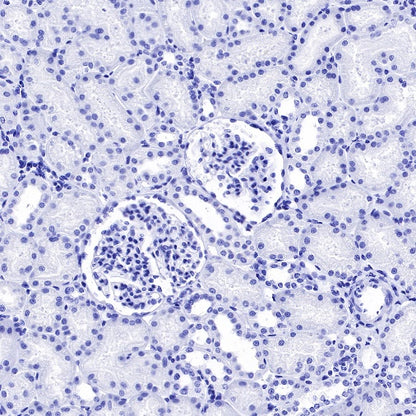 Claudin 6 Recombinant Rabbit mAb (S-521-63)
