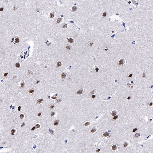 FUBP1 Recombinant Rabbit mAb (S-739-21)