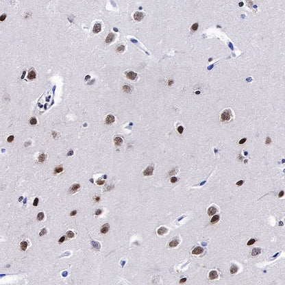 FUBP1 Recombinant Rabbit mAb (S-739-21)