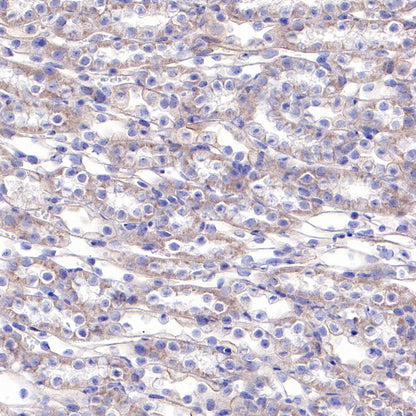 β-actin Recombinant Rabbit mAb (SDT-R156)