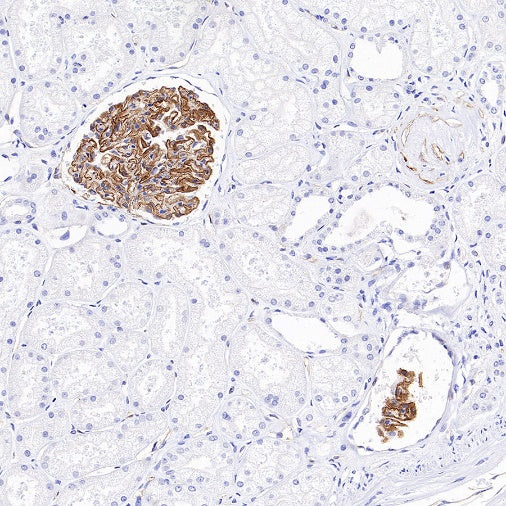 VEGF Receptor 2/FLK-1 Recombinant Rabbit mAb (SDT-1519-144)