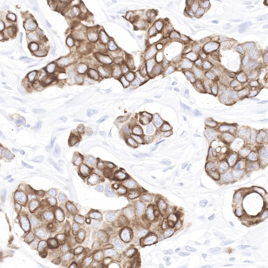 Cytokeratin 7 Recombinant Rabbit mAb (SDT-R028)