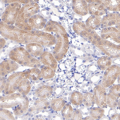 Caspase-7 Recombinant Rabbit mAb (S-782-50)