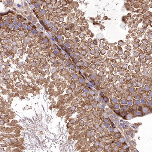 NMT1 Recombinant Rabbit mAb (S-2986-17)