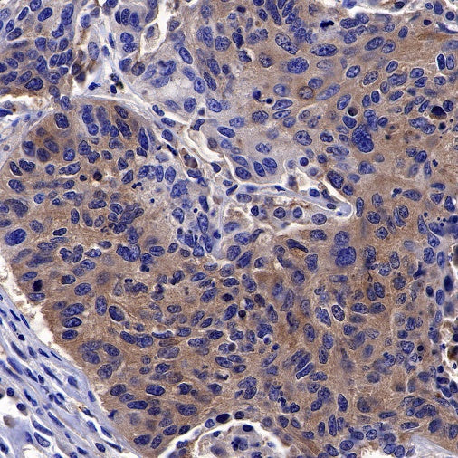 Olig2 Recombinant Rabbit mAb (SDT-648-155)