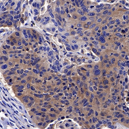 Olig2 Recombinant Rabbit mAb (SDT-648-155)