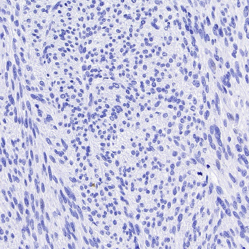 TMEM16A Recombinant Rabbit mAb (SDT-2179-68)