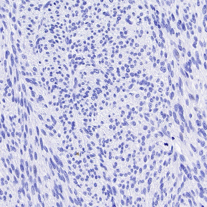 TMEM16A Recombinant Rabbit mAb (SDT-2179-68)