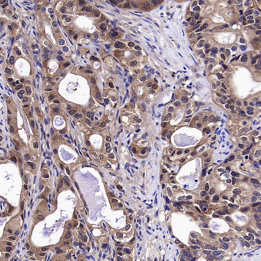 IRF3 Recombinant Rabbit mAb (S-3650-63)