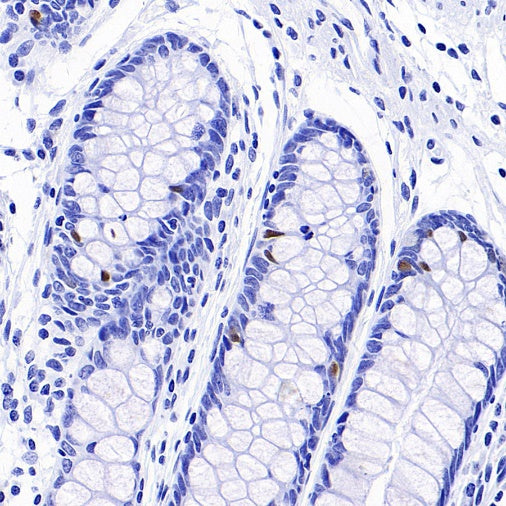 PAX6 Recombinant Rabbit mAb (SDT-1258-145)