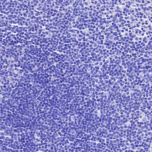 MUC4 Recombinant Rabbit mAb (SDT-R228)