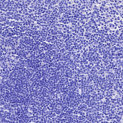 MUC4 Recombinant Rabbit mAb (SDT-R228)